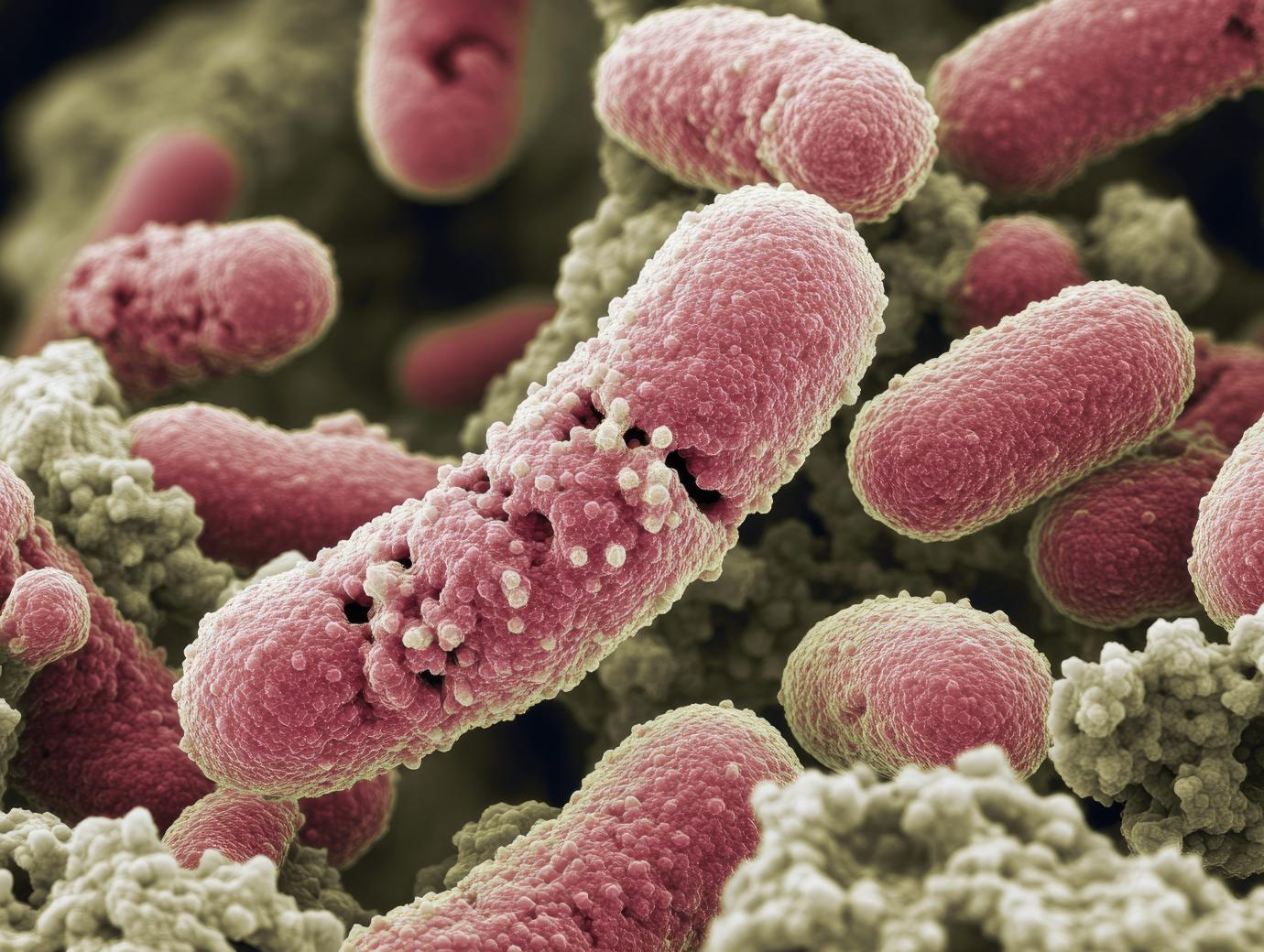 Pneumococcal disease